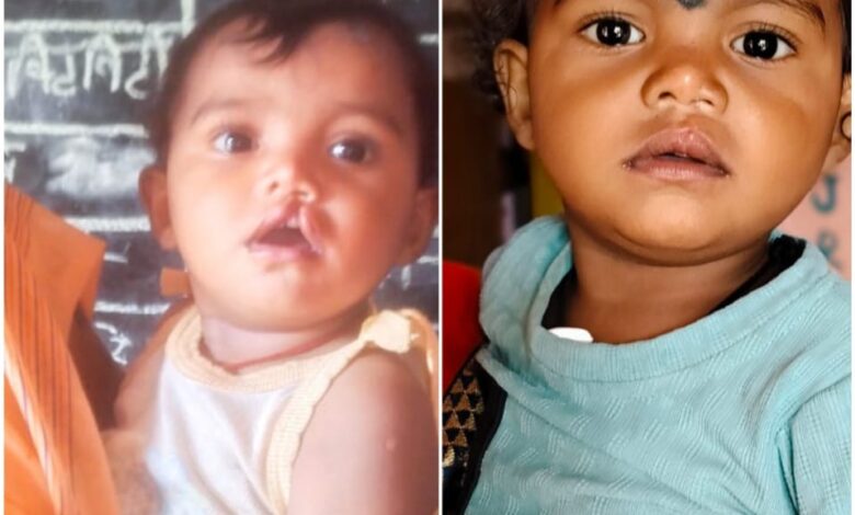 शासन की योजना से दूर हुई बेटी के भविष्य की चिंता, चिरायु दल ने लौटाई मासूम रंजना की मुस्कान…